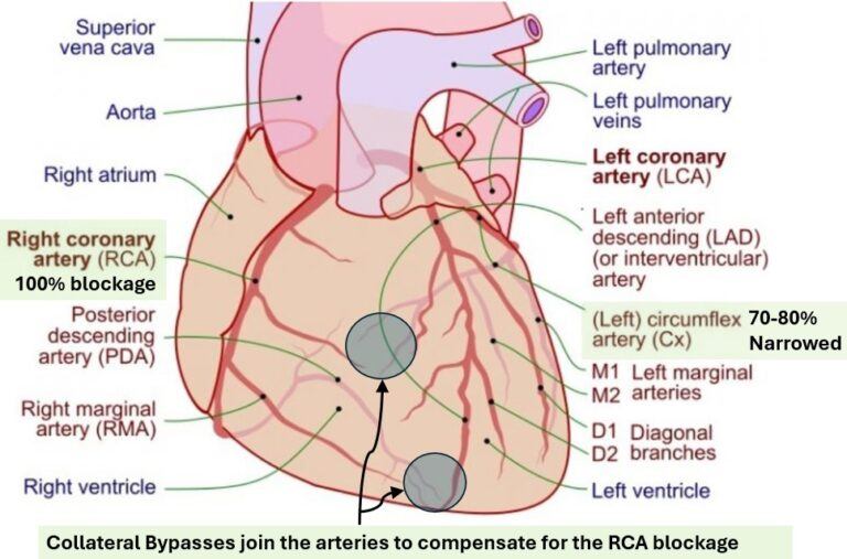 Heart Image